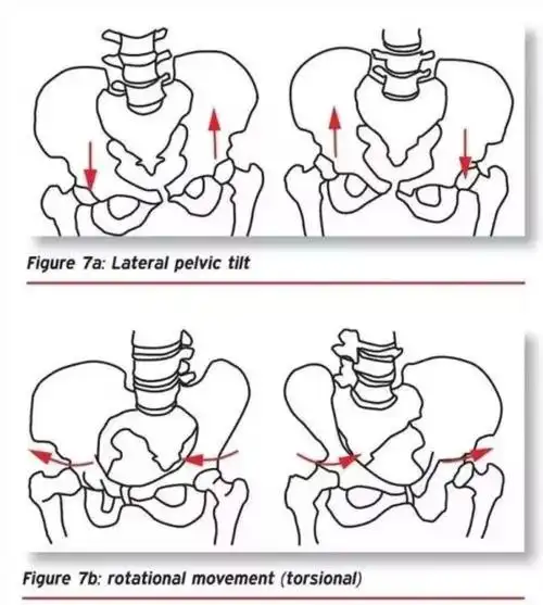 原创张天爱紧身西服泳装上热搜,但这骨盆前倾隔着屏幕都觉得疼!