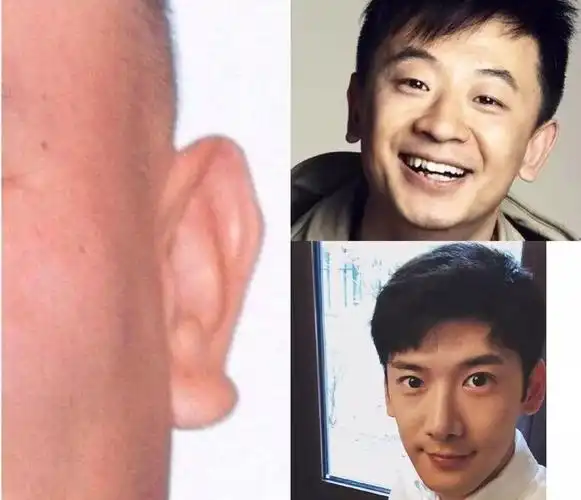 耳垂朝口是耳垂朝嘴巴的方向,不是下垂也不是翘起来,是走向与嘴角或