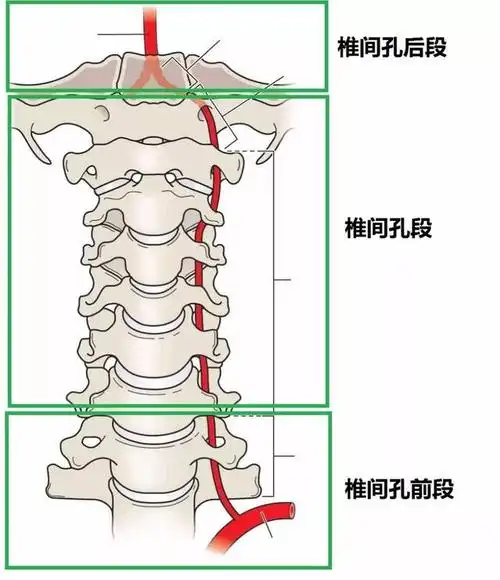 推荐椎动脉走形图谱二
