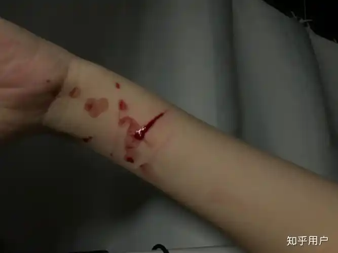 自残属于什么心理