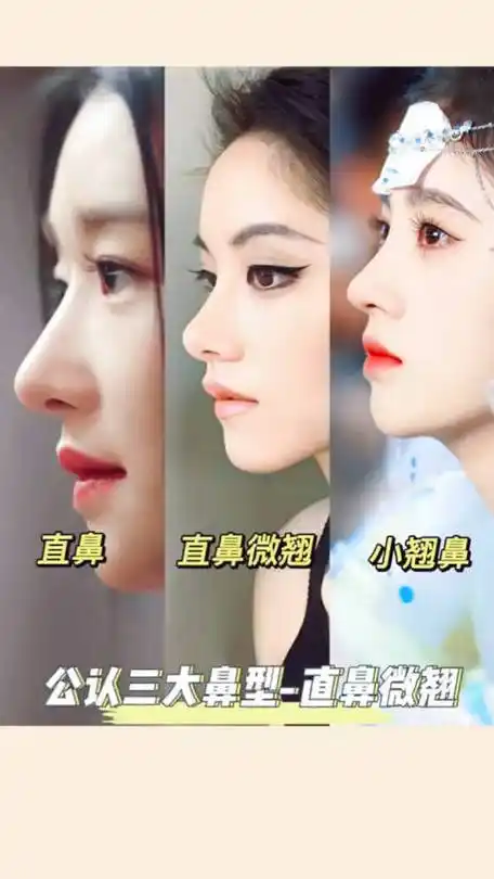 直鼻微翘鼻型知识点补充版