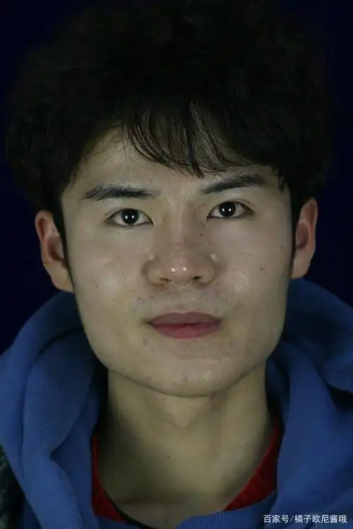 男孩下颌角宽大天生方脸自卑已久,鼓起勇气整容后,竟撞脸鹿晗
