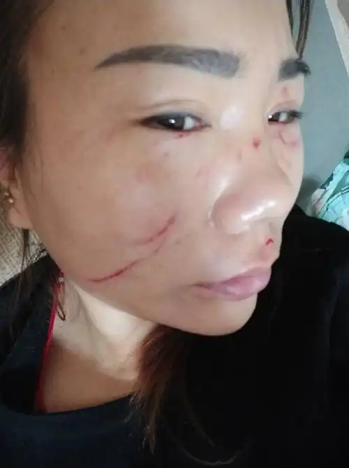 脸部受什么样的伤才算是伤害?