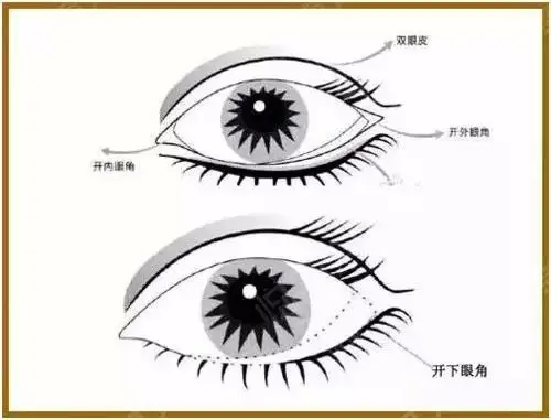 对自己的眼部形态不满意,单眼皮,内双,内/外眼角有眦皮,眼睛短小的人