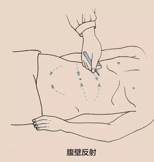 ▎提睾反射提睾反射由l1-2支配,经生殖股神经传导.