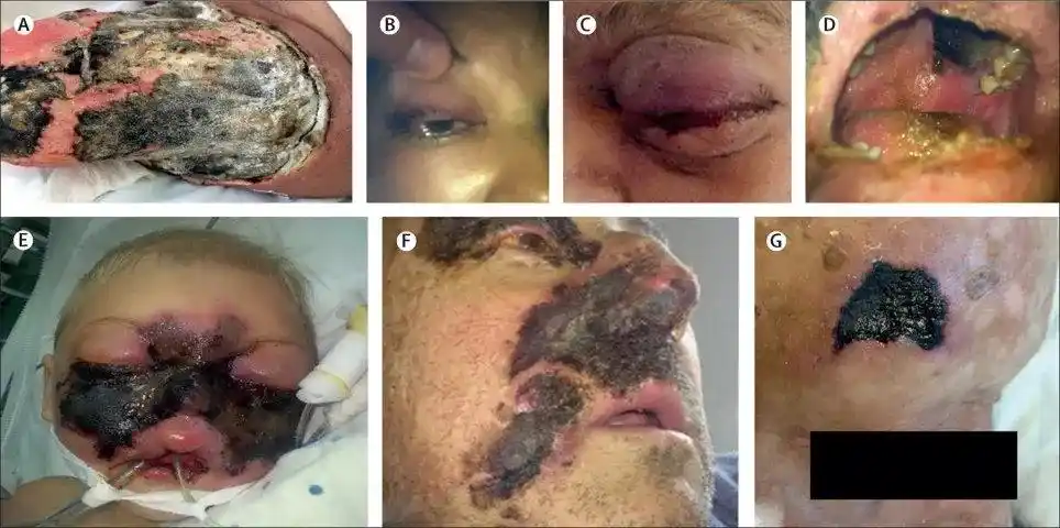 印度新冠疫情之下这个帮凶让现状雪上加霜