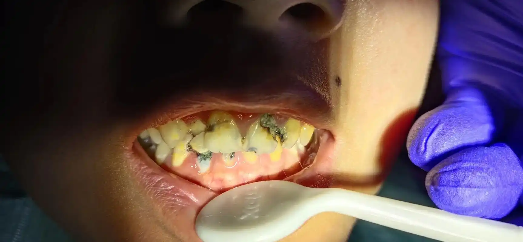 很久不发作品了别人以为我改行得久不久冒一下泡爰护牙齿要认认真真