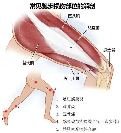 导致膝痛的原因有很多,常见的疼痛部位和原因见下图.
