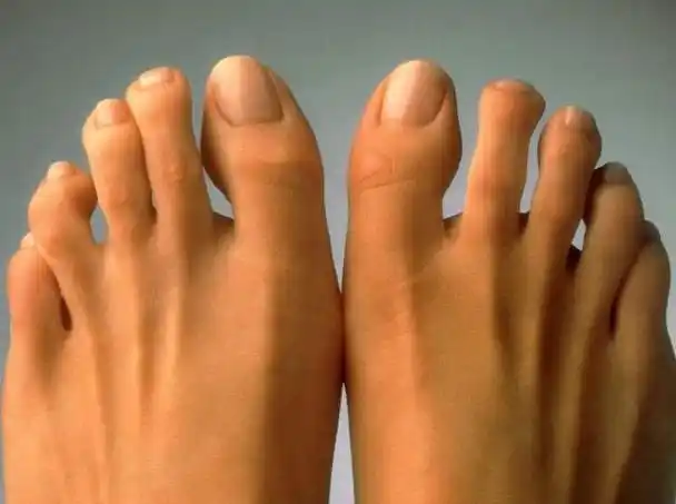 脚大拇指翘有什么说法-大脚拇指翘起来什么命