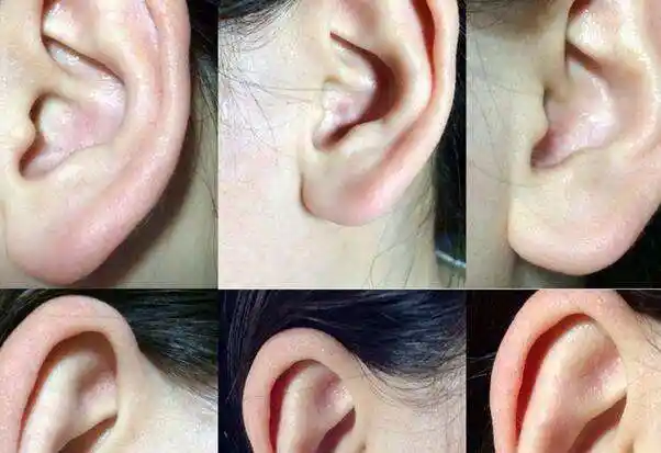 想要判断垂珠朝口其实方法非常简单,垂珠指的就是一个人的耳垂和耳珠