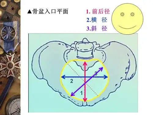 妇产科骨盆内外测量