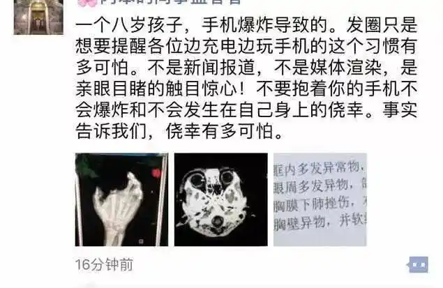 可怕|用正在充电手机玩游戏发生爆炸,南宁 8 岁男孩手被炸烂