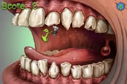 为什么大牙容易被虫吃?