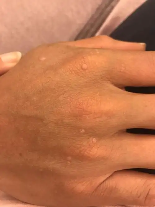 手背上的这些白点点是什么?脸上这些黑点点又是什么?