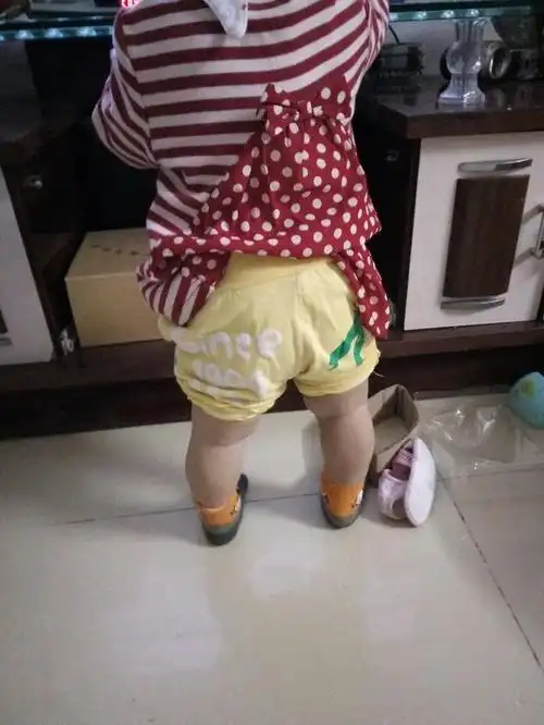 为什么孩子会变成o型腿?跟父母的这些行为有很大关系
