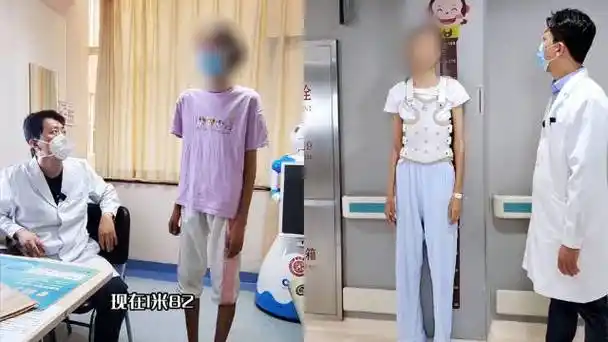 畸形病专家王宇接触到一名脊柱侧弯的13岁女孩,但是她身高却有1米82高