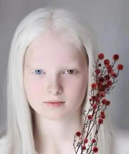 俄罗斯白化病瞳孔异色症少女照片惊艳网络网友称她的美超凡脱俗