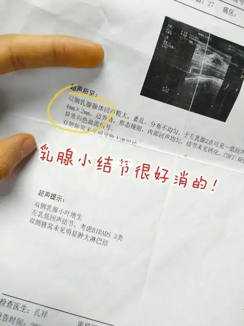 姐妹们,跟大家说,良性的乳腺结节,尤其是你的结节还没超过2厘米的