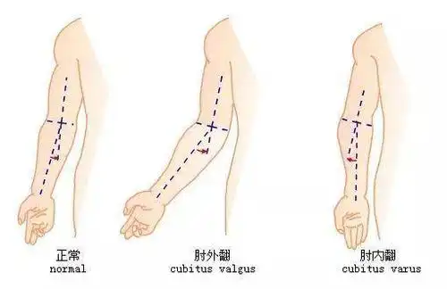 阮经天镜头下,杨幂的胳膊竟然弯成120度!太可怕!