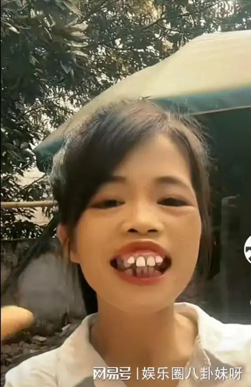 凭借奇葩长相走红网络,他们"一丑成名",但却一个比一个有钱|网红|阿sa