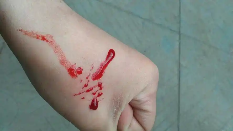 闲的没事干到自残 hhh 我除了父母一无所有