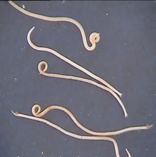 展开全部 这是线虫.