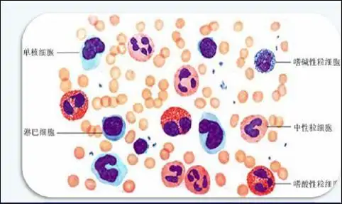 红细胞|贫血|白细胞|血小板_网易订阅