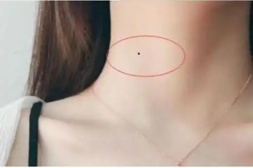 珍惜脖子上有三颗痣