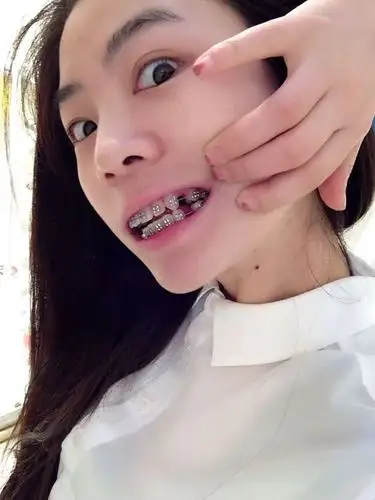 有虎牙是一种怎样的体验