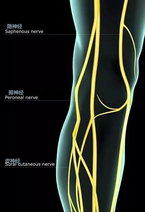 隐神经卡压综合征