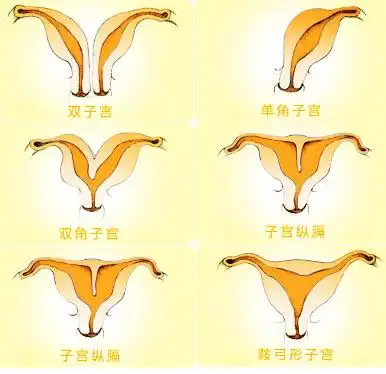 宫颈畸形的种类宫颈畸形的种类有很多,对于女性来说自己的宫颈形态