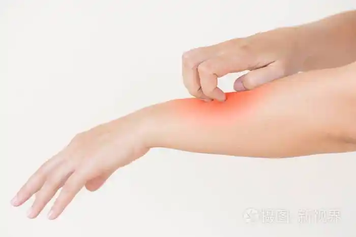 在家中手抓痒的女人手