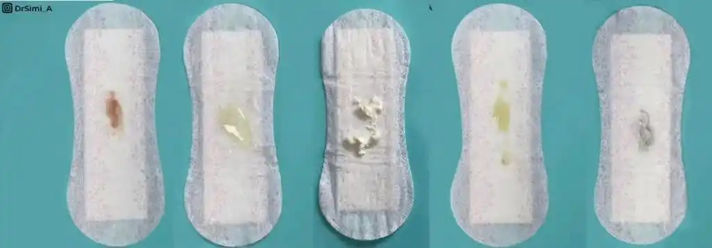 女生内裤上出现这4种情况要当心