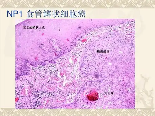 病理学实验切片复习要点2