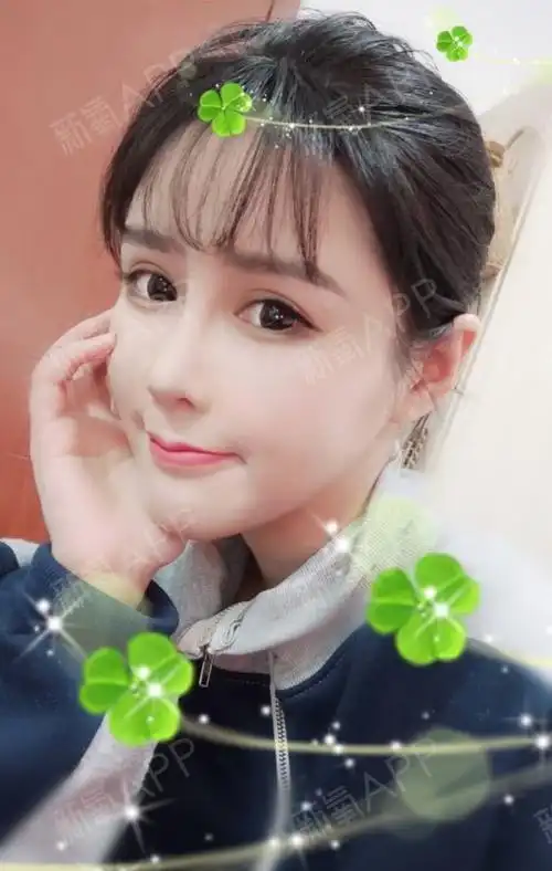 韩式小翘鼻第7天】已经一个星期了,昨天去医院拆了_圈子-新氧美容整形