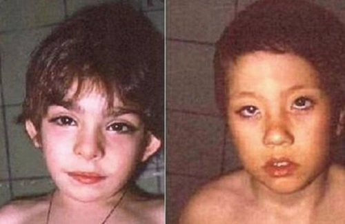 根据临床针对歌舞伎面谱综合征多年的调查研究来看,专家认为它的病发