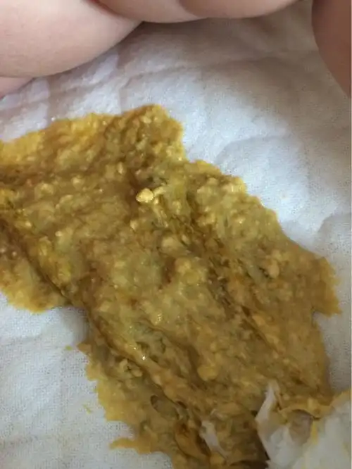 这样的大便是消化不良吗