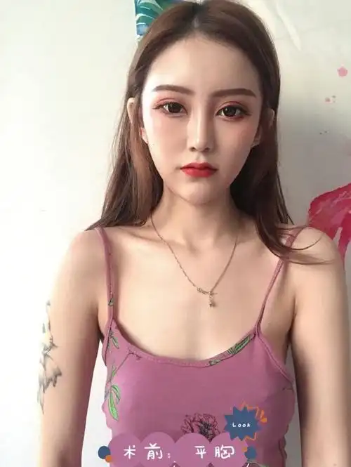 [:95][:95][:95]飞机场变人间胸器!平_圈子-新氧美容整形