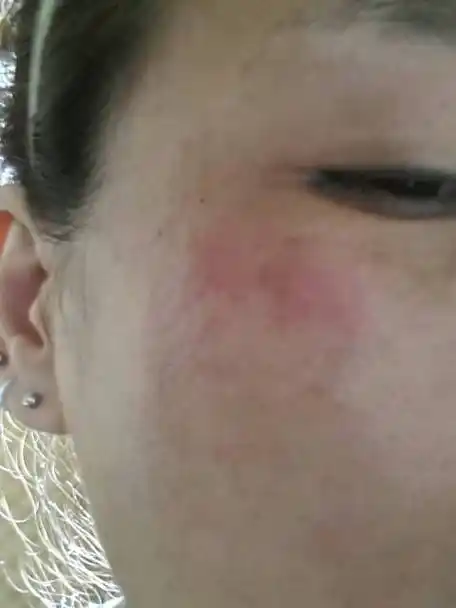 脸发红是怎么回事(脸发红发烫怎么解决)_大全-幸福起航