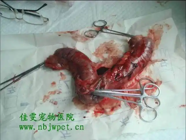 子宫切除医保2017年11月28日癌症子宫切除花了20000乡村医保报销吗