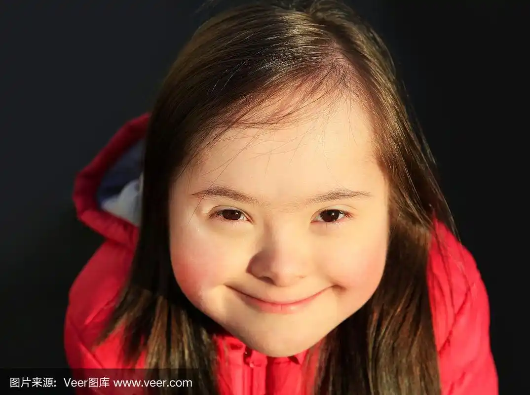 唐氏综合症女孩微笑