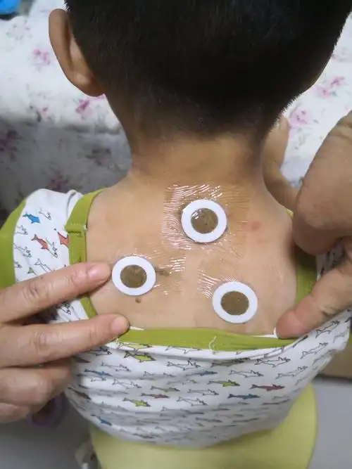 小儿,贴敷,0.5—2小时.