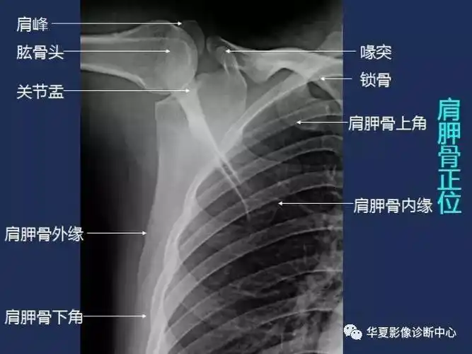 x线解剖图谱肩胛骨