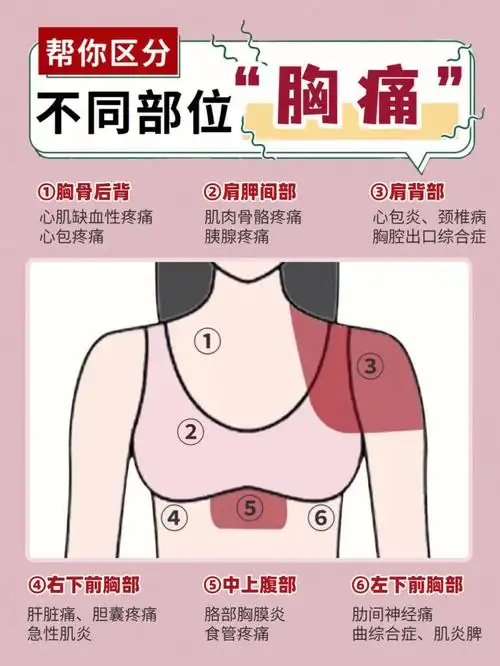 胸闷胸痛71快看看不同部位胸部疼痛对应疾病