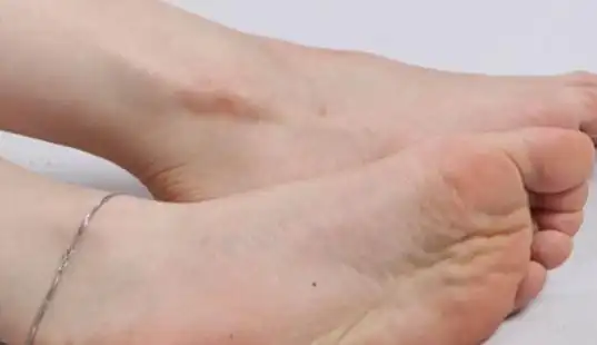 小腿有痣的女人代表什么意思 小腿有痣的女人命运好不好