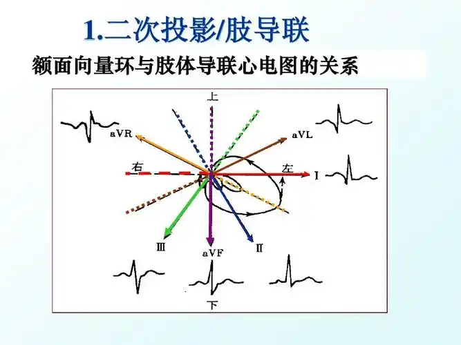 二次投影/肢导联 额面向量环与肢体导联心电图的关系