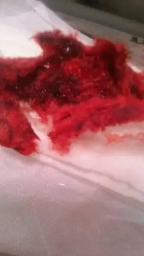 捡的家里同夫异母的卫生巾,这黑色的东西是啥?