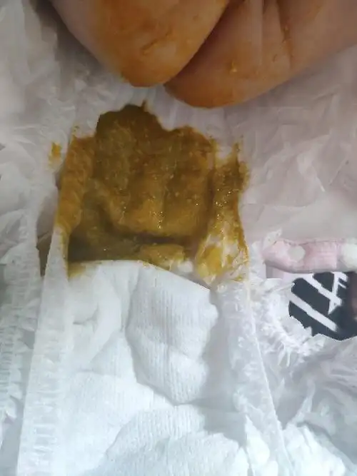 2019-06-22 23:28:13 点赞 |3936_3953楼主 :感觉差不多哎,是不是便秘