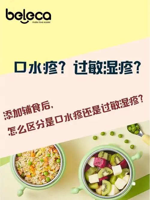 口水疹过敏湿疹宝宝的这些症状你知道吗