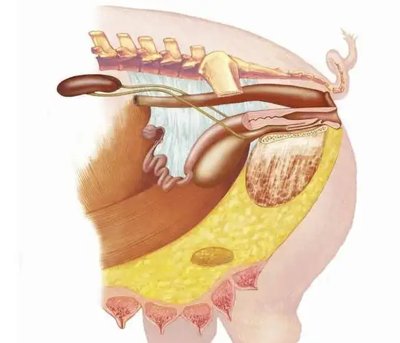 母猪子宫炎不用怕,3种类型母猪子宫炎的治疗方法都在这里